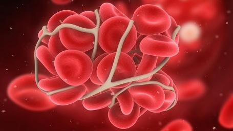 Всемирный день гемофилии